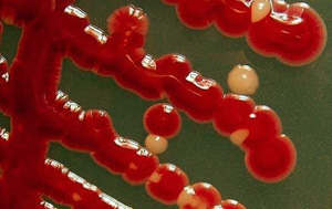 Serratia marcescens