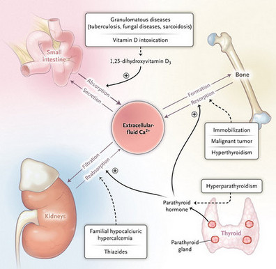 Common causes of hypercalcemia, 