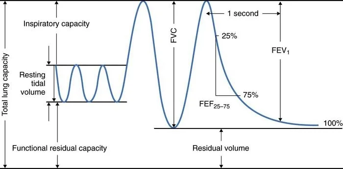 pulmonary-function-fig1_large.jpg