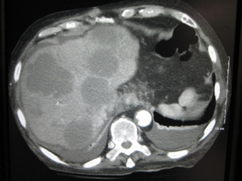 Courtesy of UCSF image bank