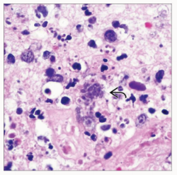 Tachyzoites