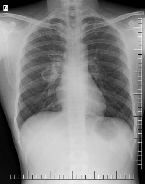 From radiopaedia.org