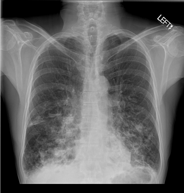 Representative Radiographic Imaging- Radiopaedia.org