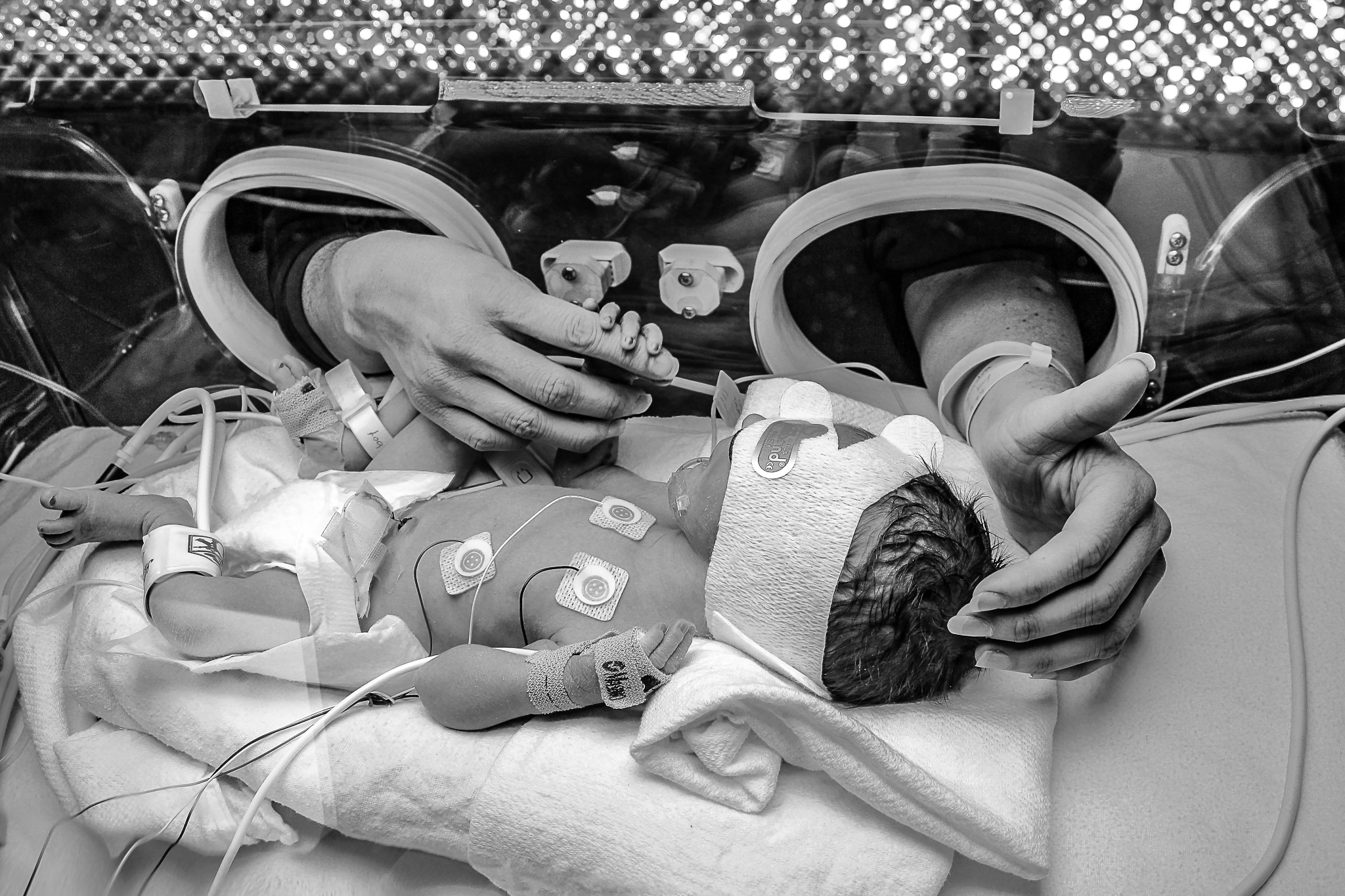 nicu_photography_hprhs_hypoplasticheart_photojournalism_newyork_mountsinai_hospital_photo_preemie_nyc_heart_defect--3.jpg