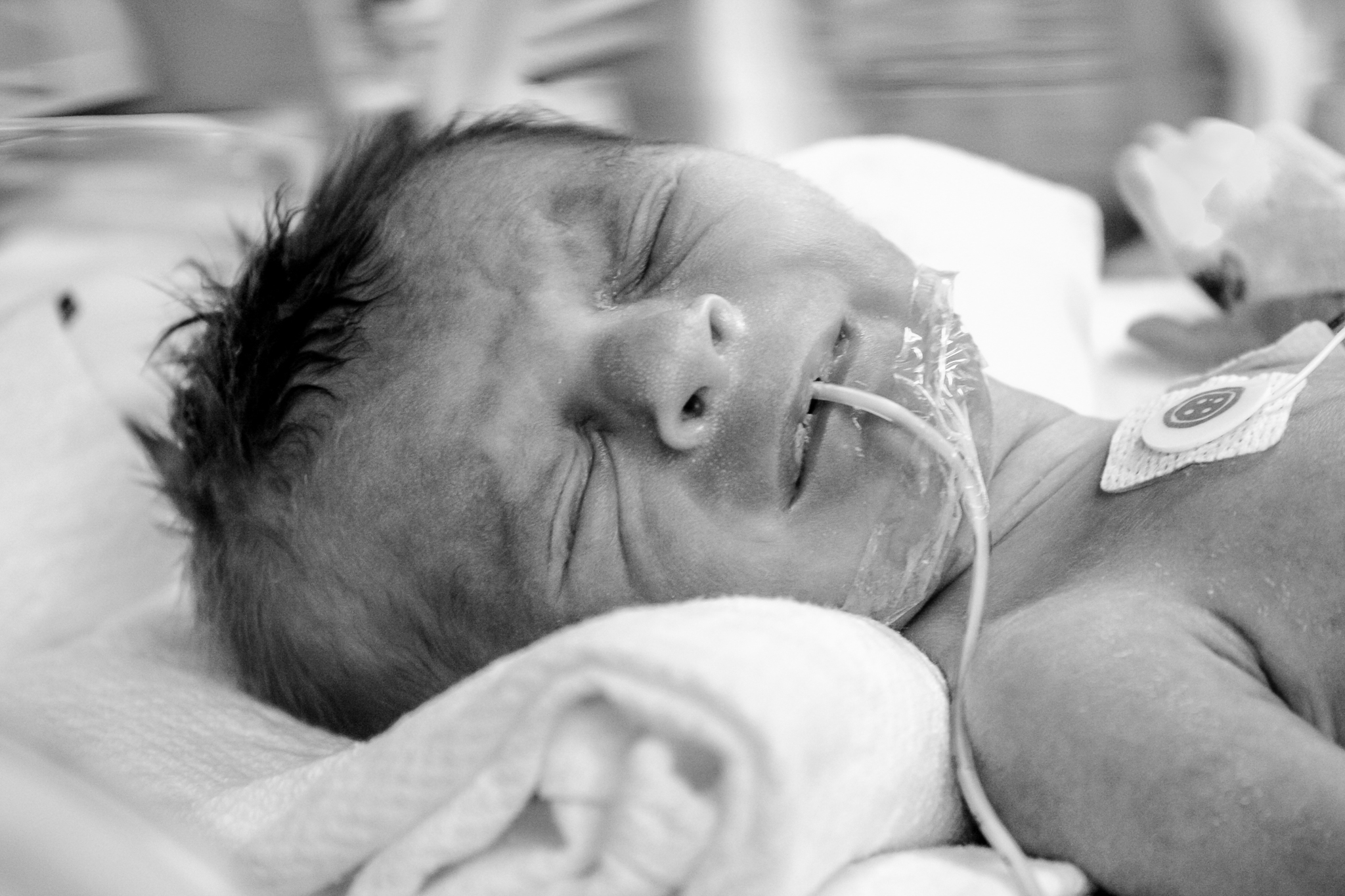 nicu_photography_hprhs_hypoplasticheart_photojournalism_newyork_mountsinai_hospital_photo_preemie_nyc_heart_defect-116-2.jpg