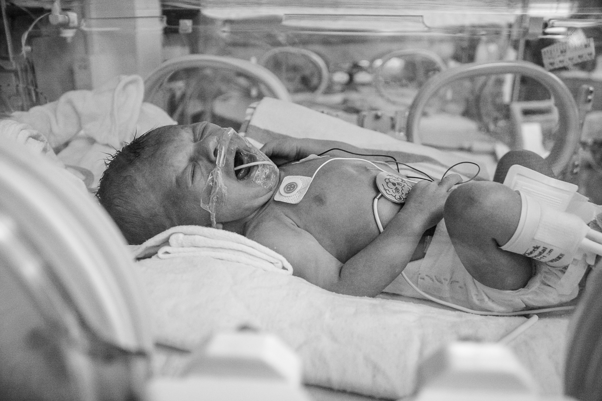 nicu_photography_hprhs_hypoplasticheart_photojournalism_newyork_mountsinai_hospital_photo_preemie_nyc_heart_defect-272-2.jpg