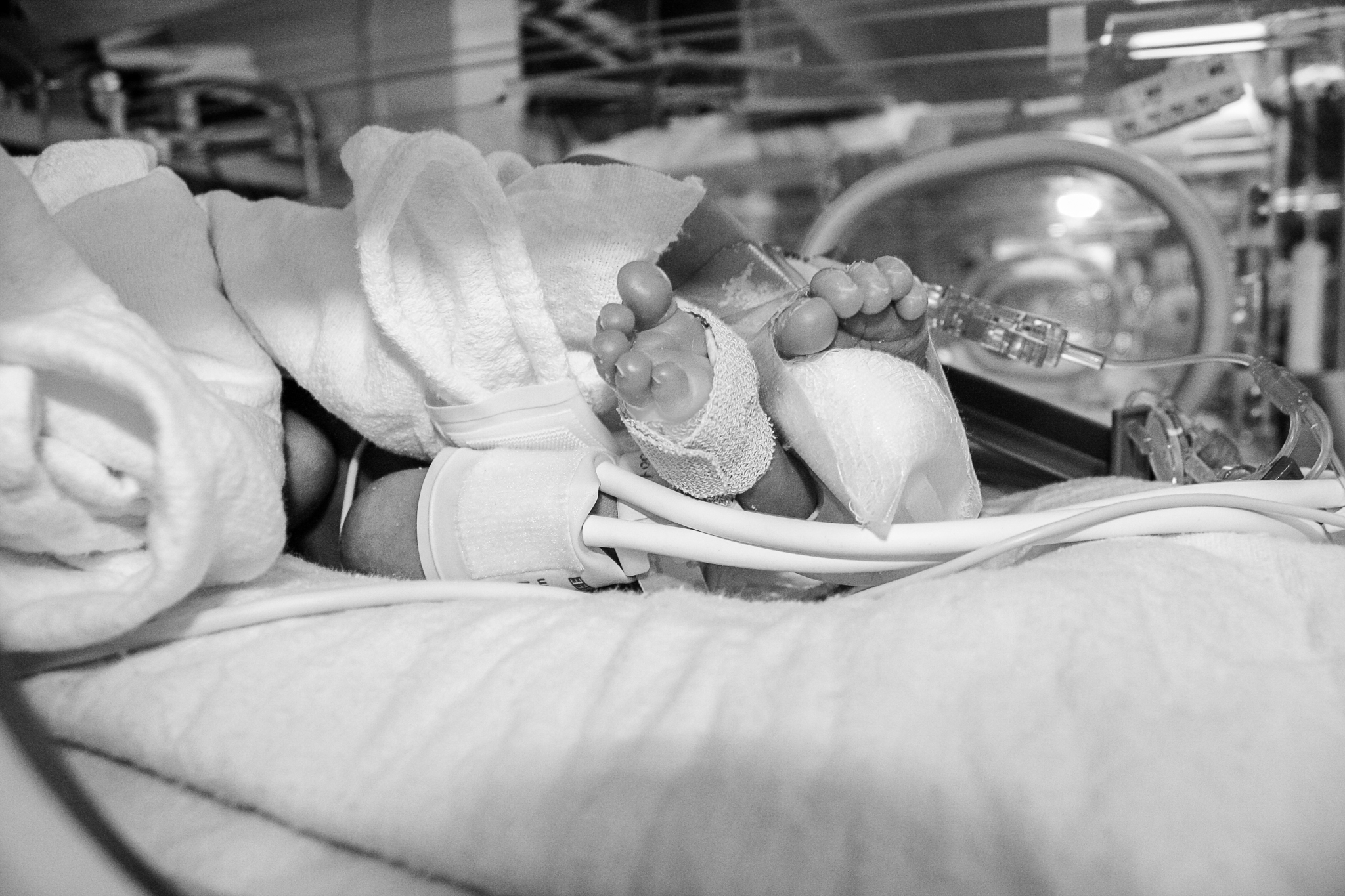 nicu_photography_hprhs_hypoplasticheart_photojournalism_newyork_mountsinai_hospital_photo_preemie_nyc_heart_defect-210.jpg