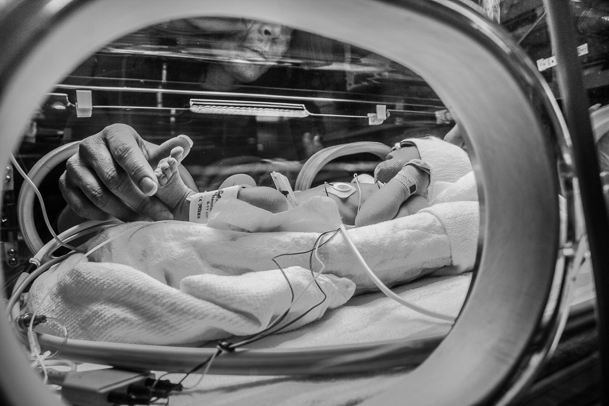 nicu_photography_hprhs_hypoplasticheart_photojournalism_newyork_mountsinai_hospital_photo_preemie_nyc_heart_defect--2.jpg