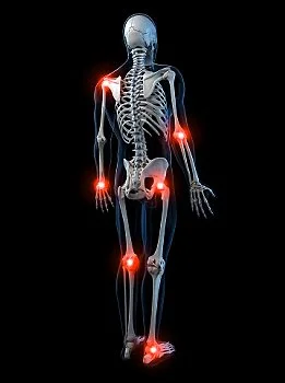 Q&A Overuse Injuries 