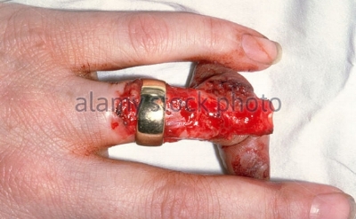 This picture is only for strong nervousness!!!!