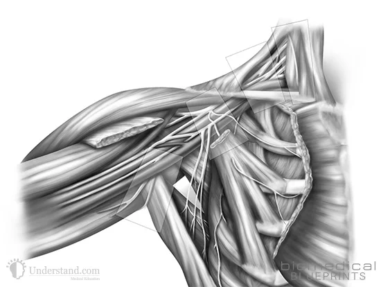 Brachial Plexus
