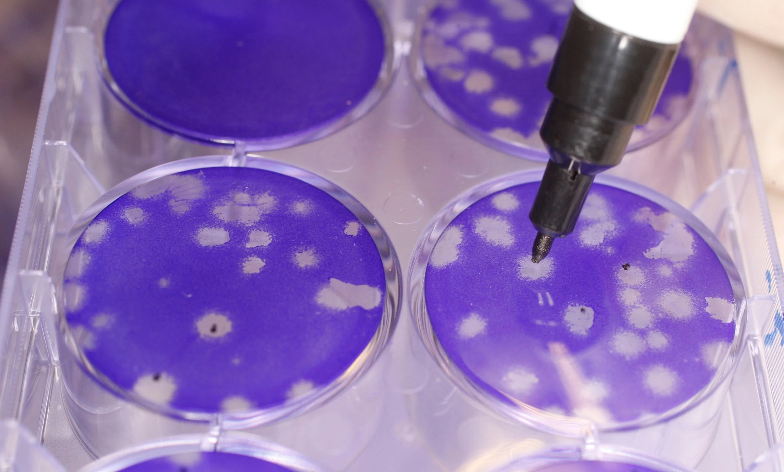 Viral plaques being manually counted to determine the viral titer using using the traditional plaque assay.