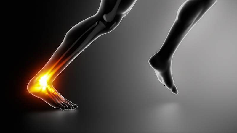 Achilles pain can be debilitating and frustrating if not treated properly.