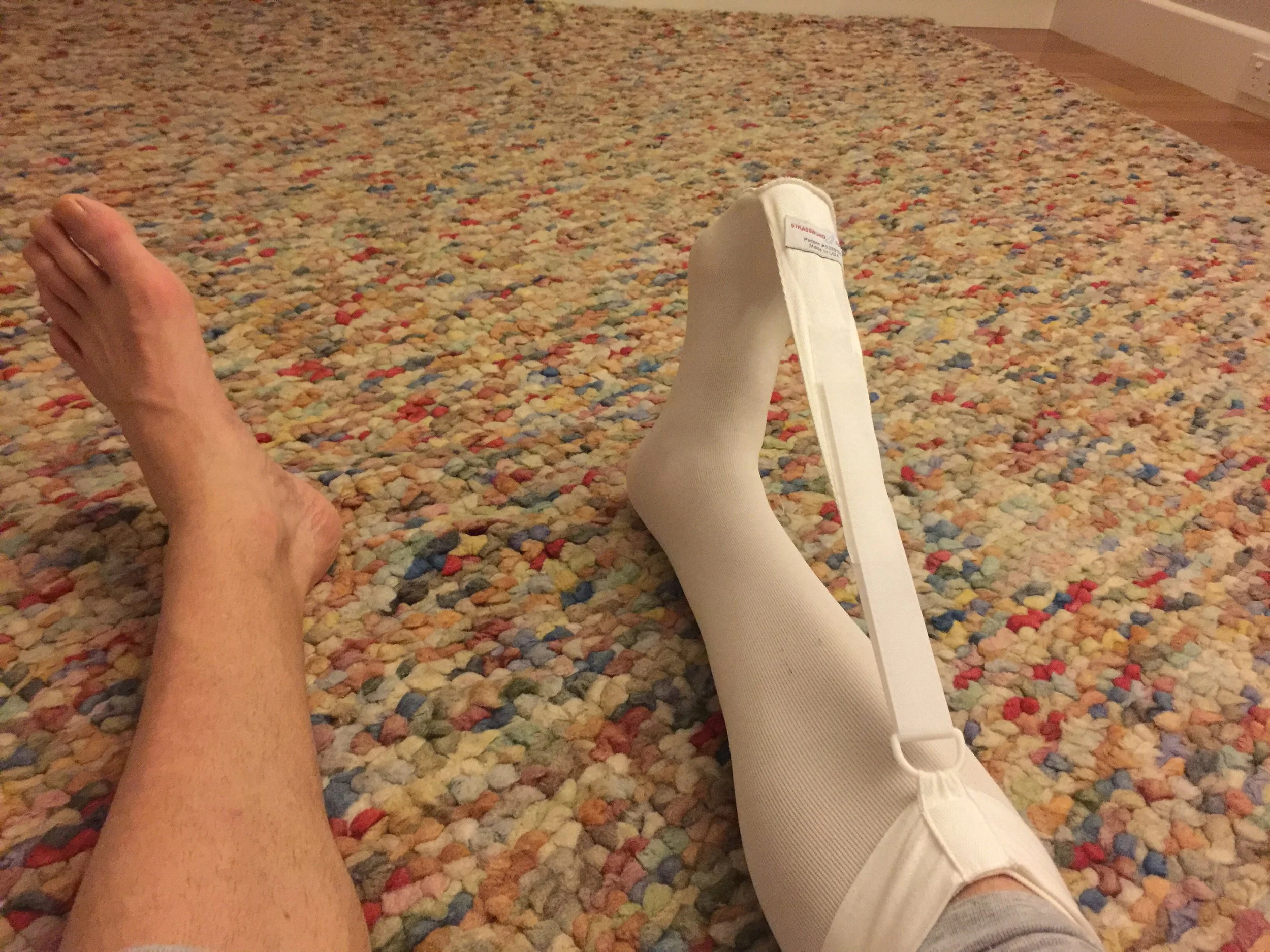 Strasburg sock; integral to Achilles & plantar fasciitis recovery & management