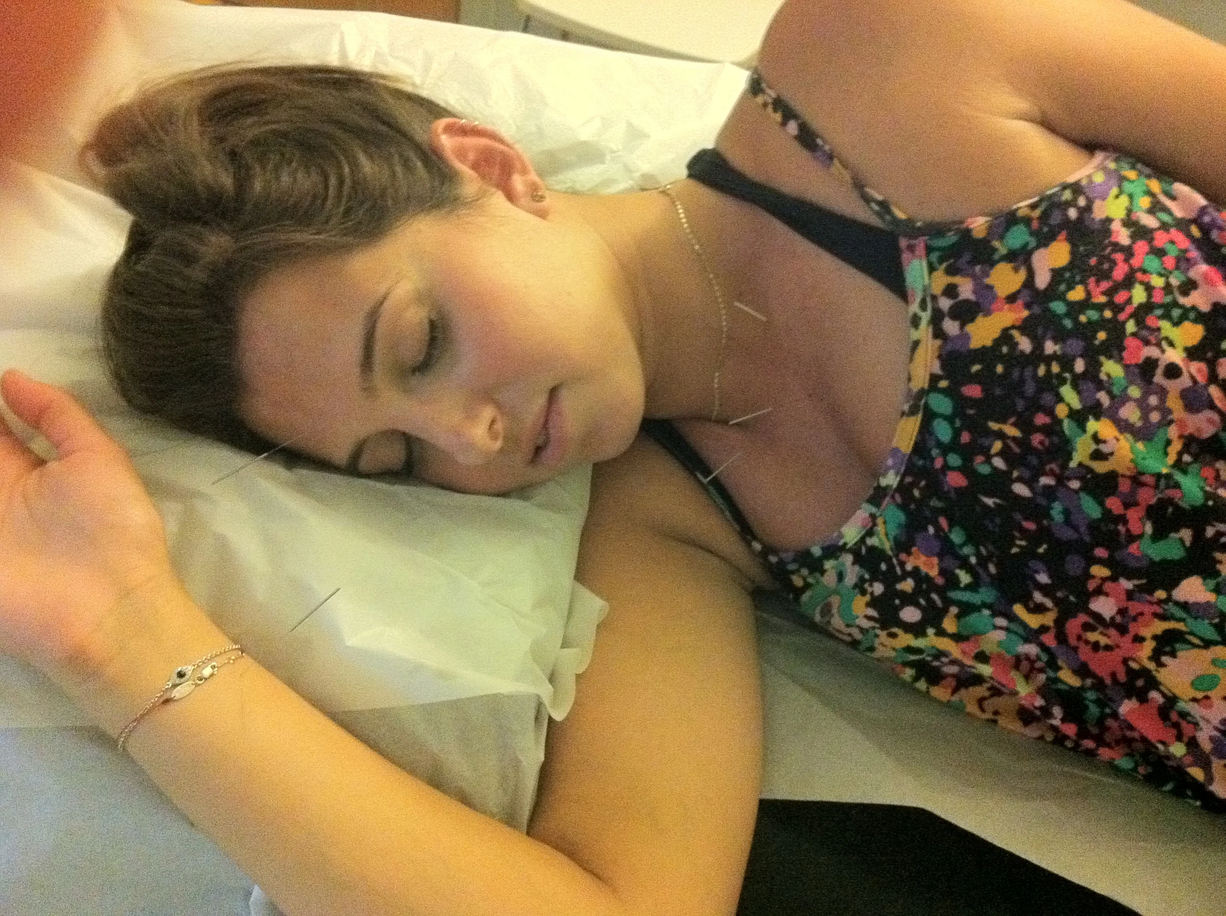 Acupuncture with Benjamin Craig L.Ac.