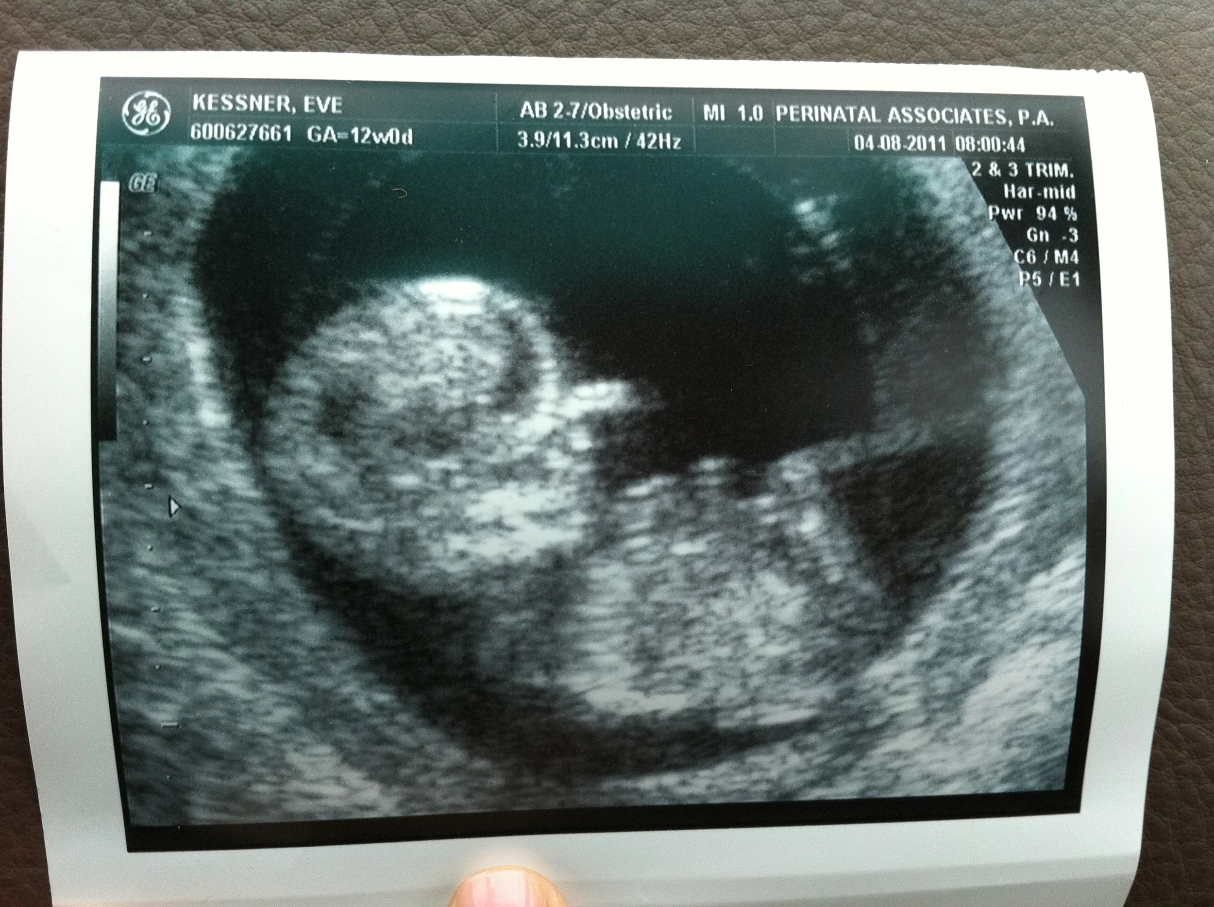 Love Life and Lollipops- Pregnancy Week 13