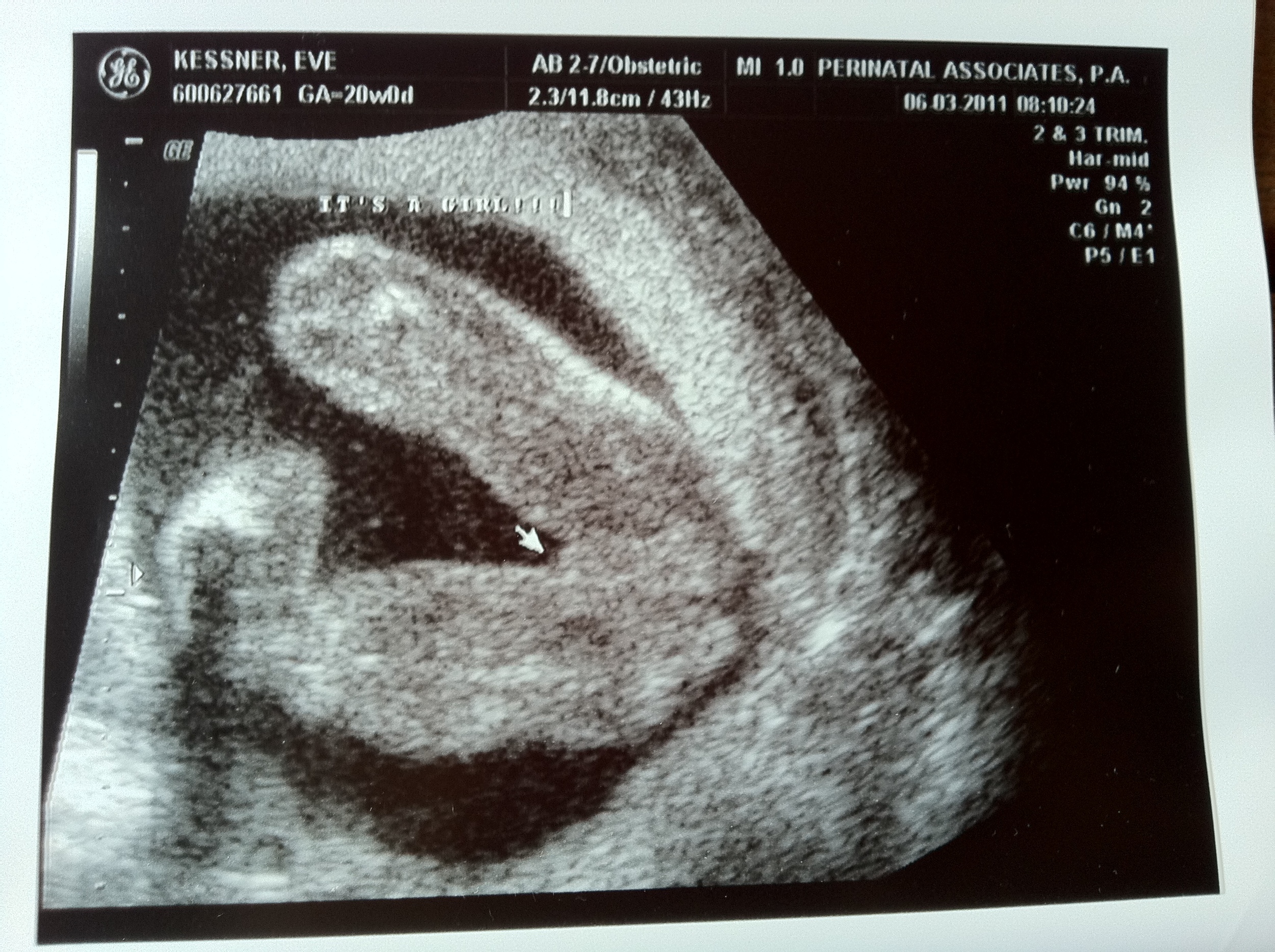Love Life and Lollipops- It's A Girl!!!