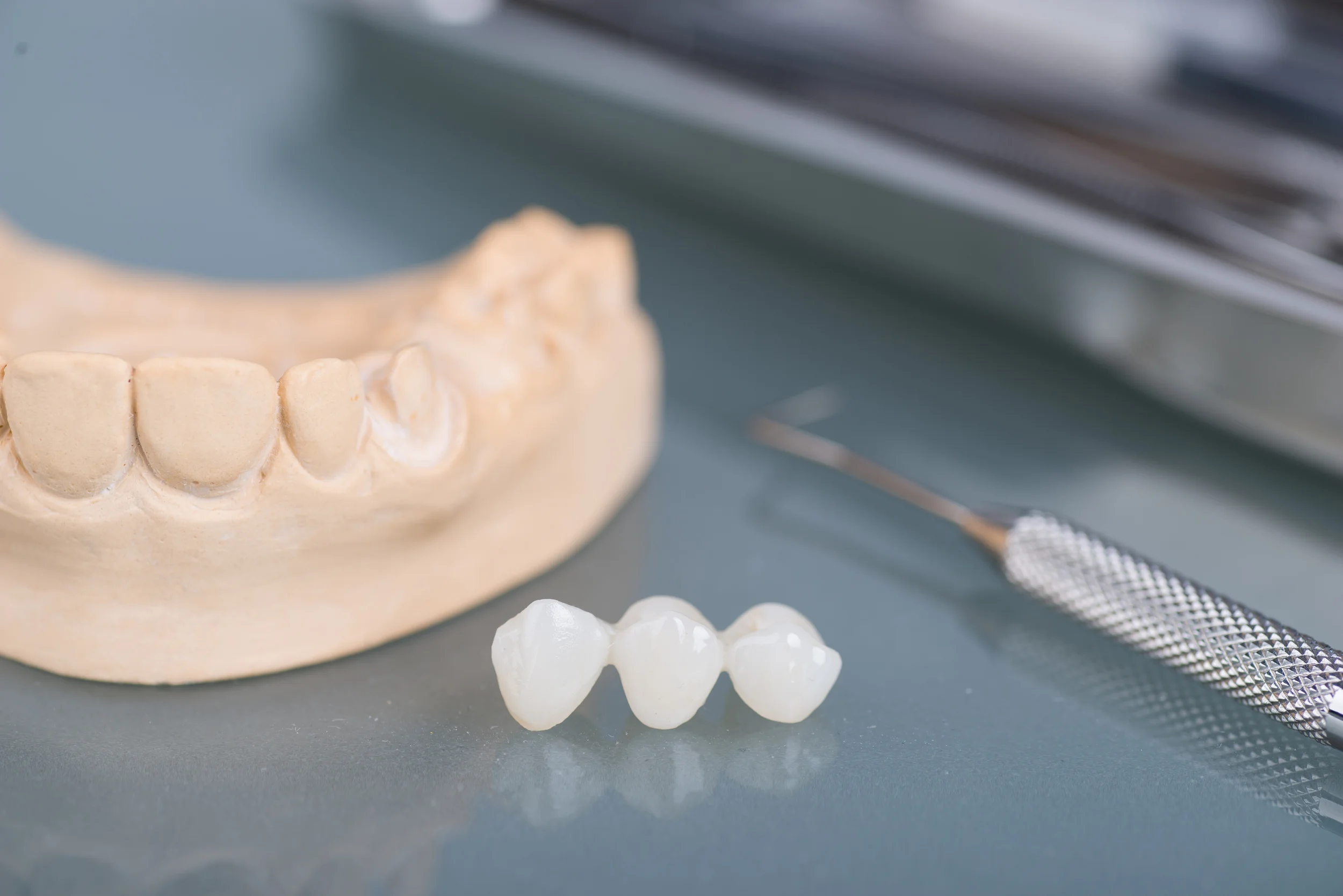 Bayfield Family Dentistry Dental Bridges