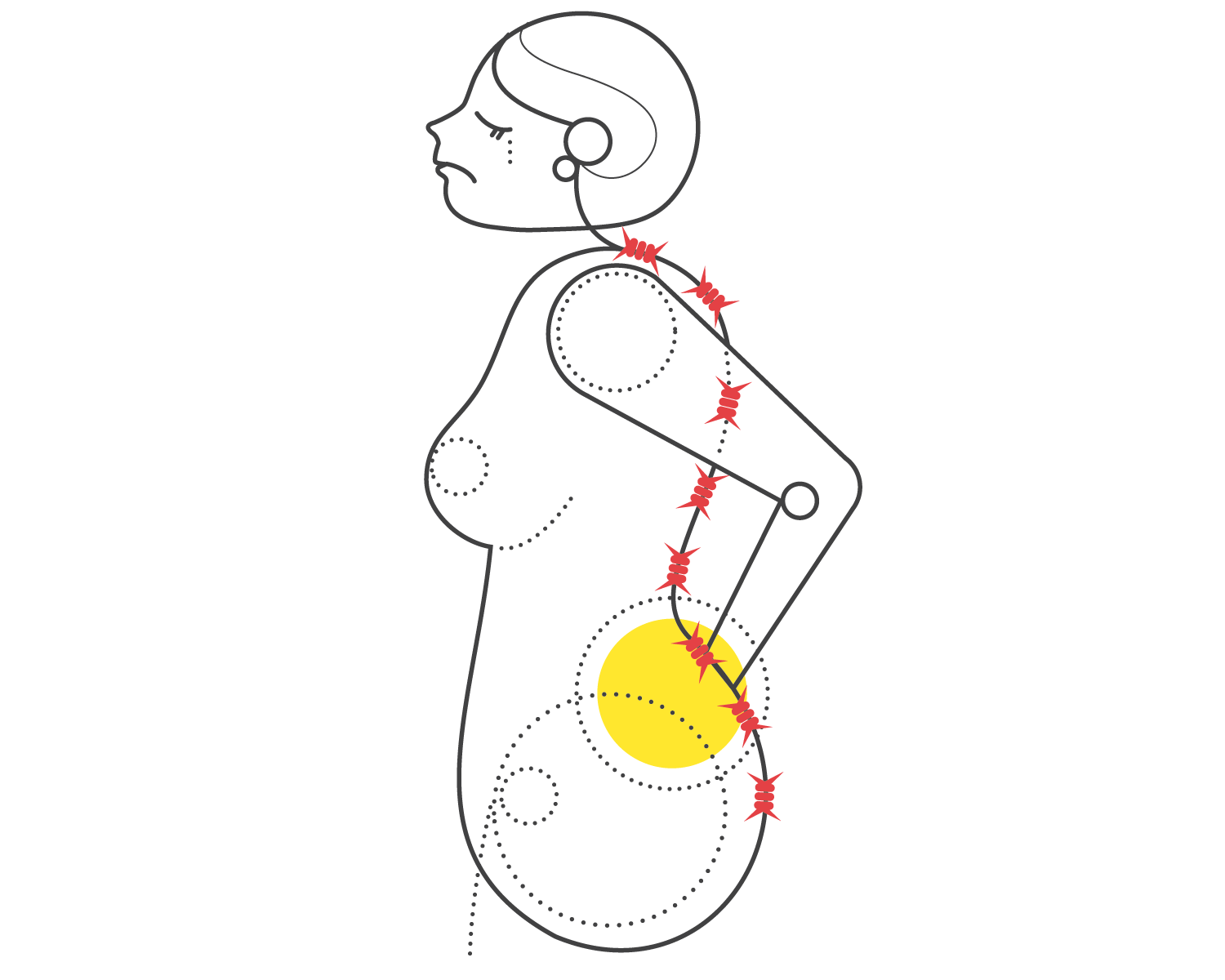 Back-Pain.gif