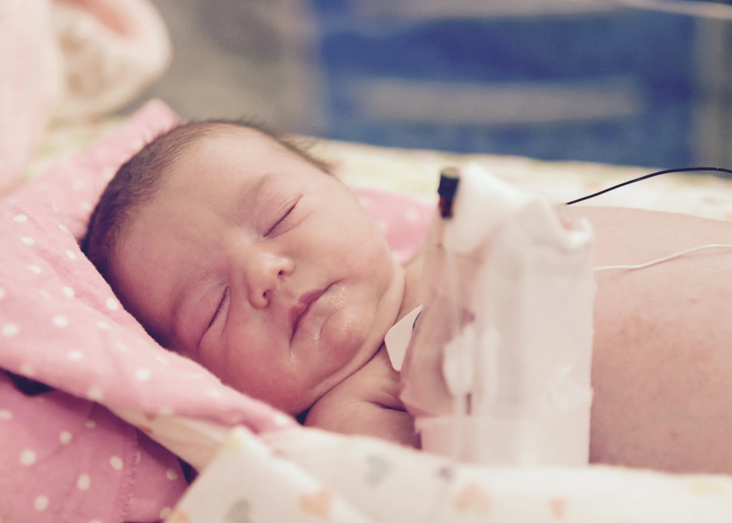 Baby nat filter.jpeg