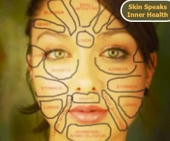 Face Mapping to "Spot the Problem" and it's Link to your Internal Health
