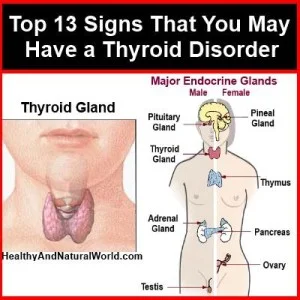  13 Signs That You May Have a Thyroid Disorder:  Hypo or Hyper? 