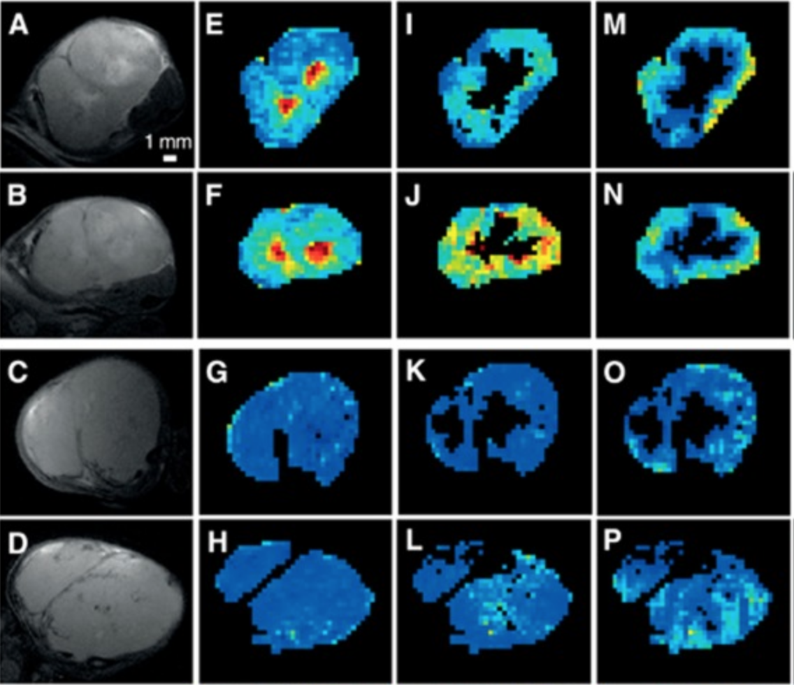 MRI reveals the in vivo cellular and vascular response to BEZ235 in ovarian cancer xenografts with different PI3-kinase pathway activity.