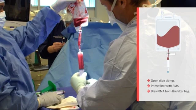 BMAC capture trim (Copy)