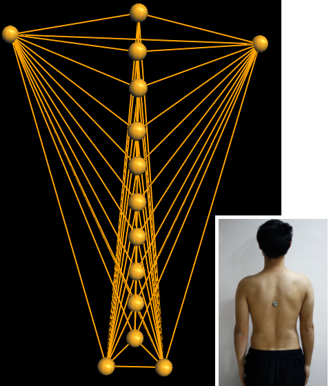 Trunk Sway Angle Estimation