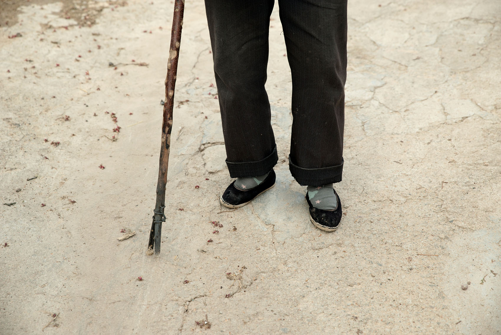 Wang Huanguo needs a stick to walk with her bound feet.