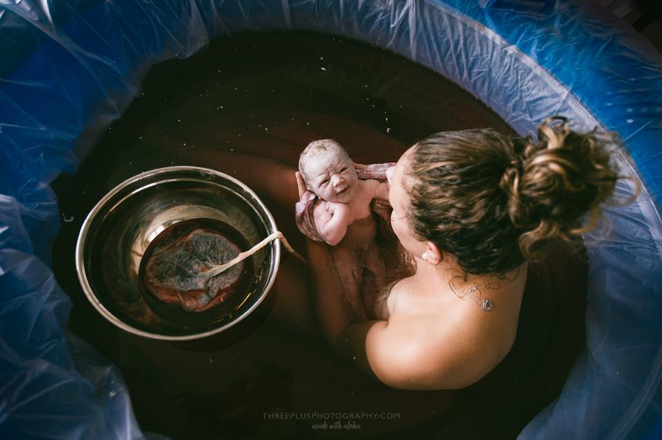 Water Birth: Benefits, Risks, Costs, What to Expect, and More