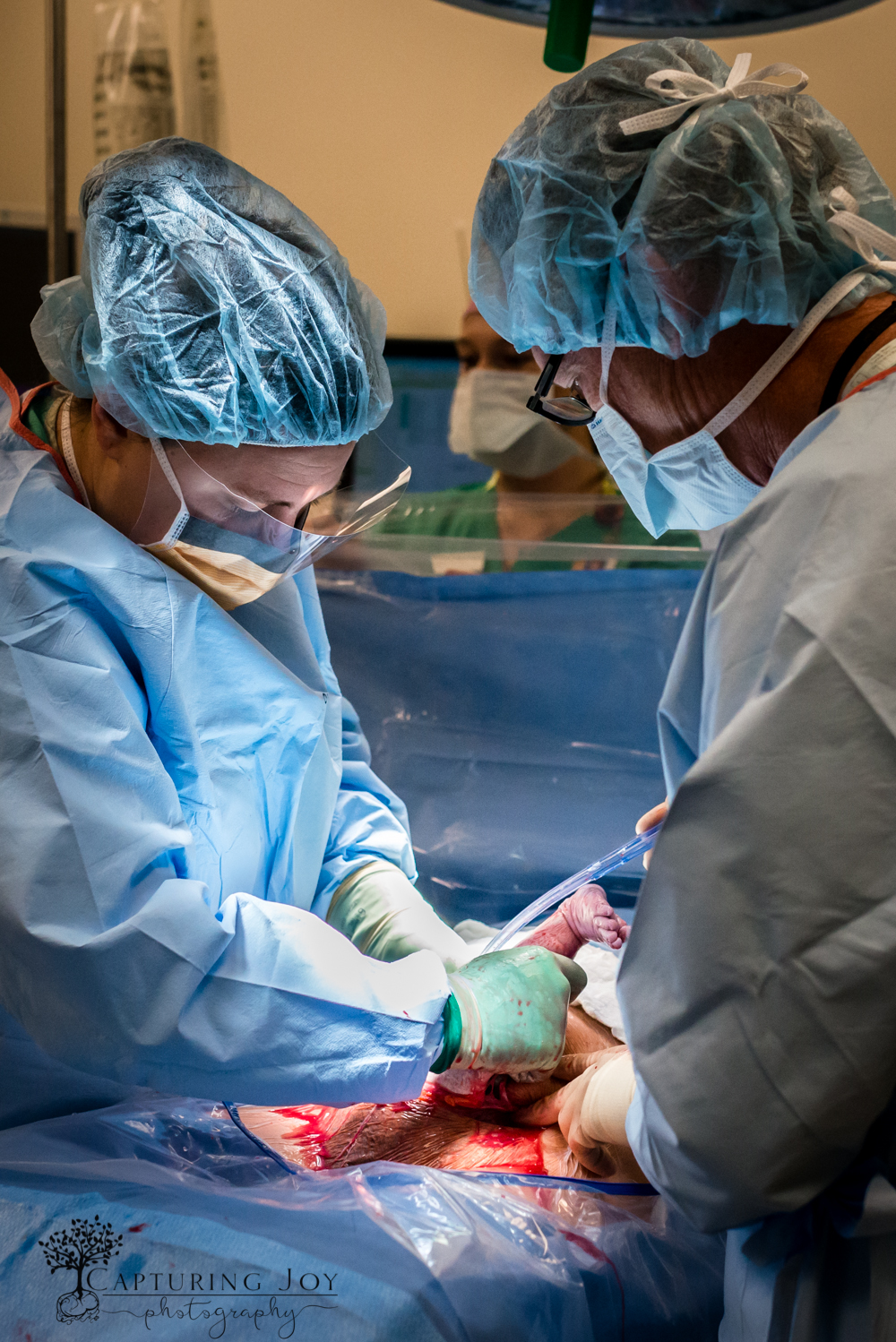 denver birth photography c section
