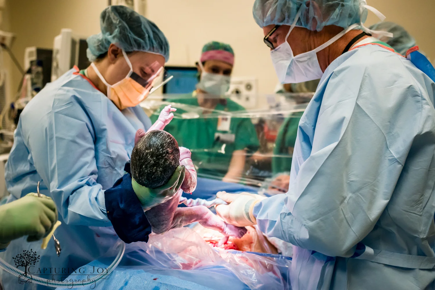 denver birth photography c section