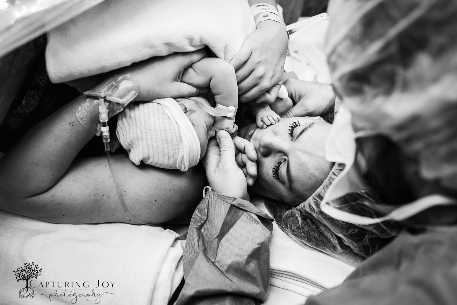 denver birth photography c section