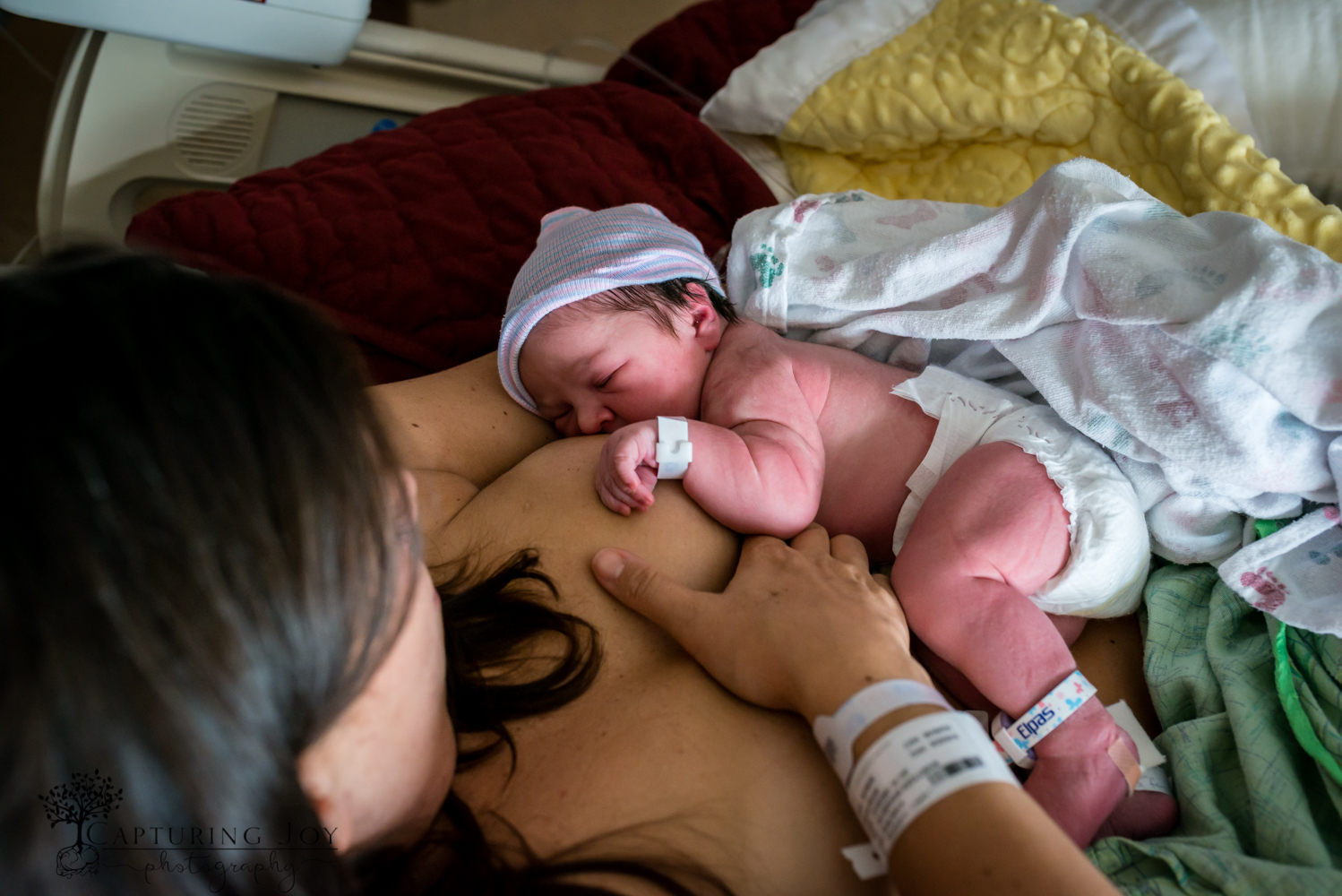 denver birth photography c section