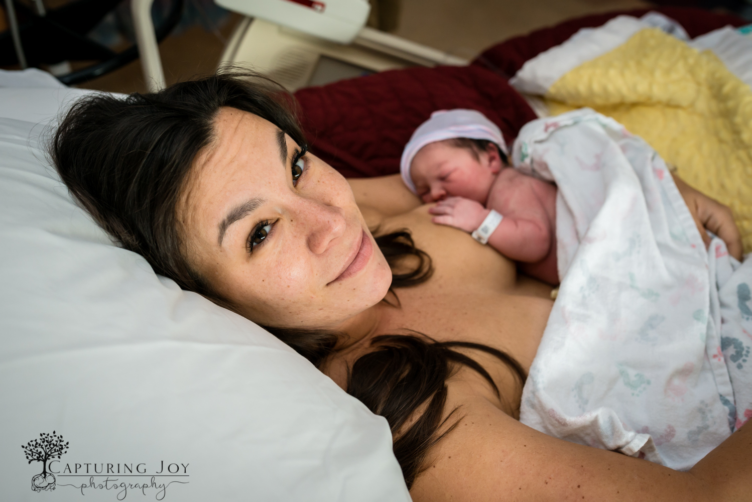 denver birth photography c section