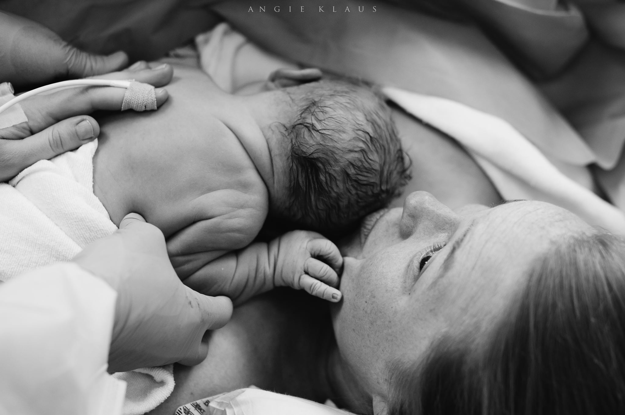 Mama and baby enjoying their first moments skin-to-skin in the operating room. www.angieklaus.com