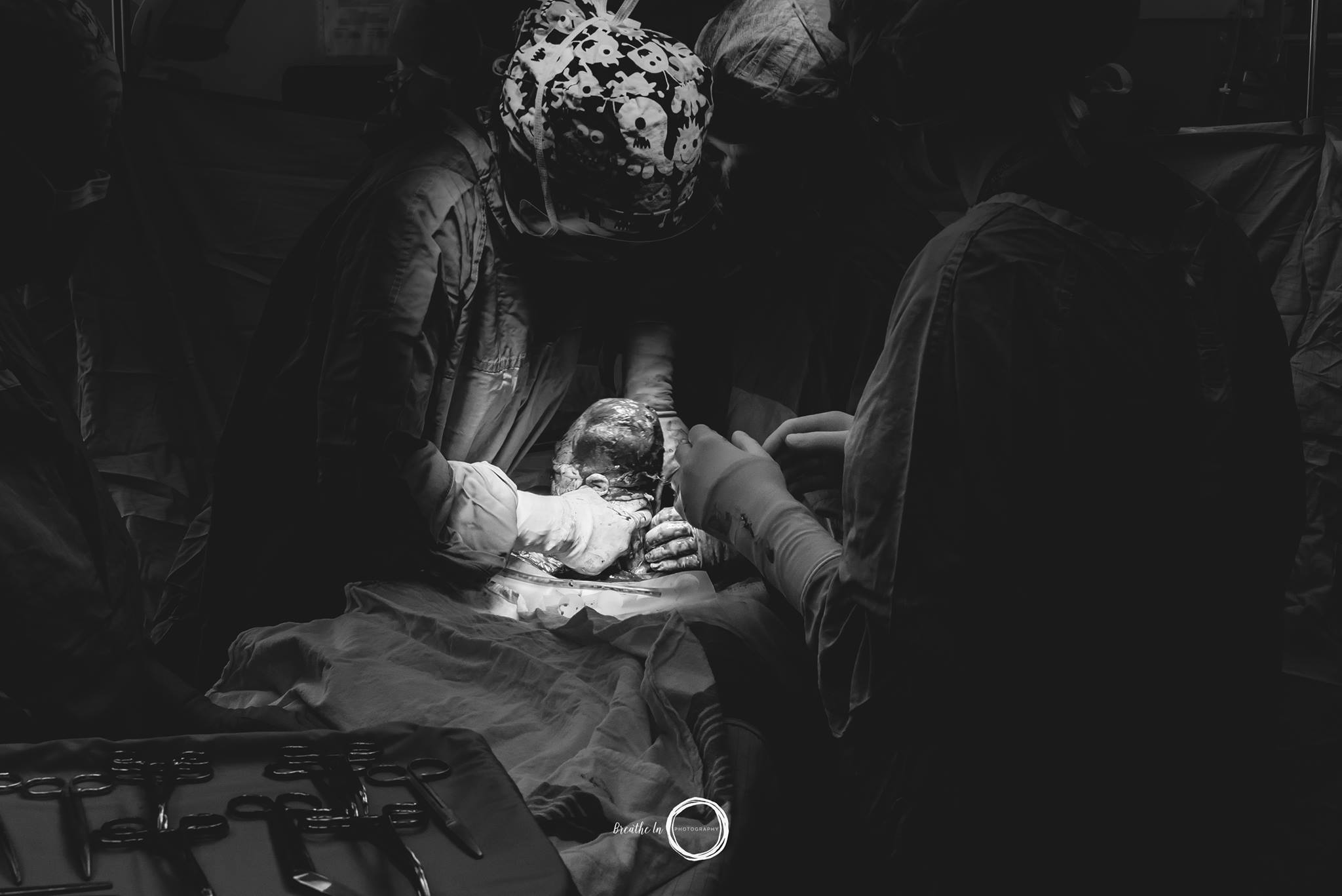 This beautiful girl was born by Cesarian and carried straight into her mom's view. Breathe In Photography - Ottawa Birth Photographer