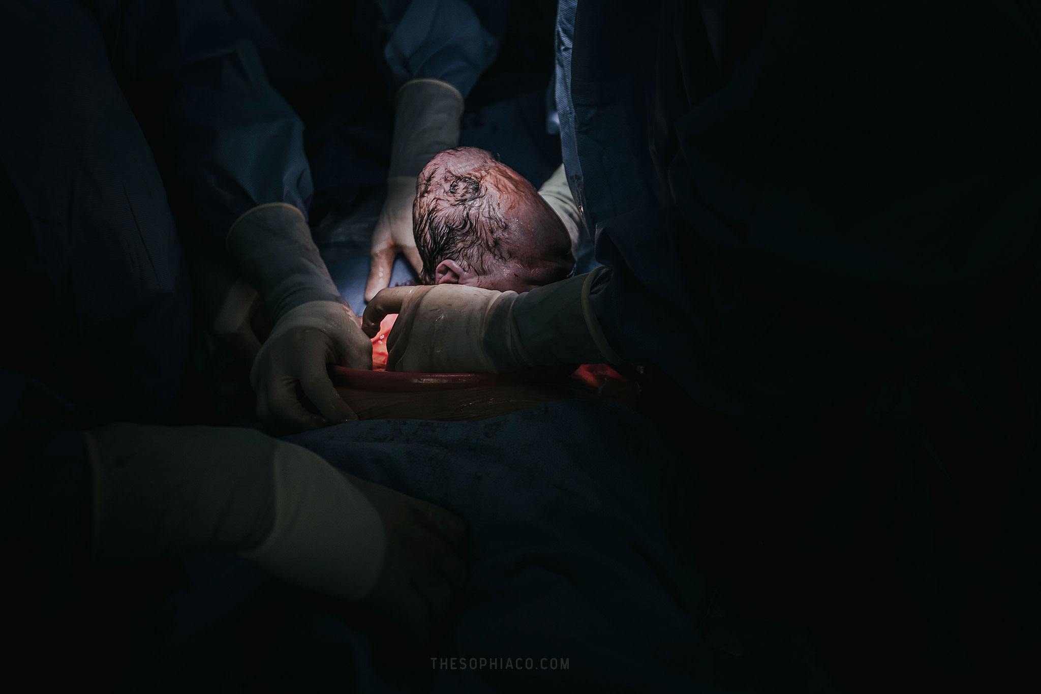 c section birth photography hawaii
