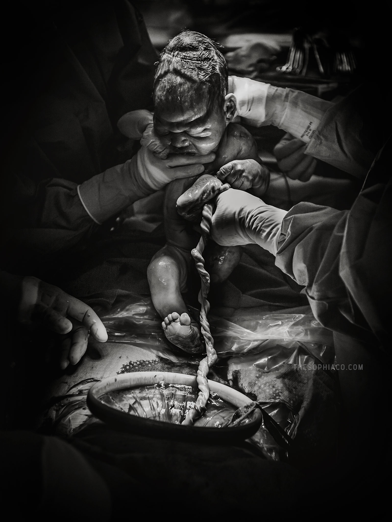 c section birth photography hawaii