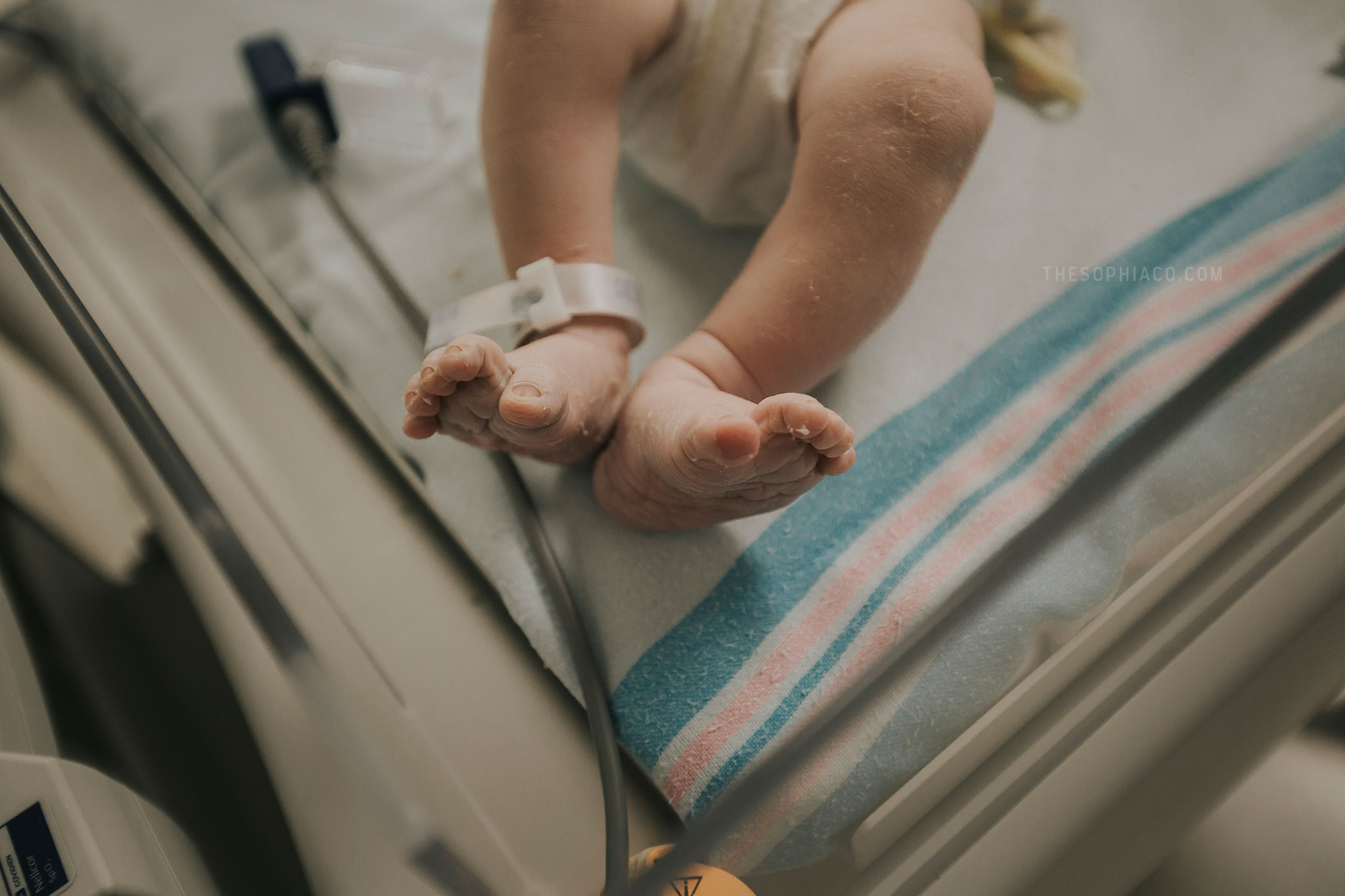 c section birth photography hawaii