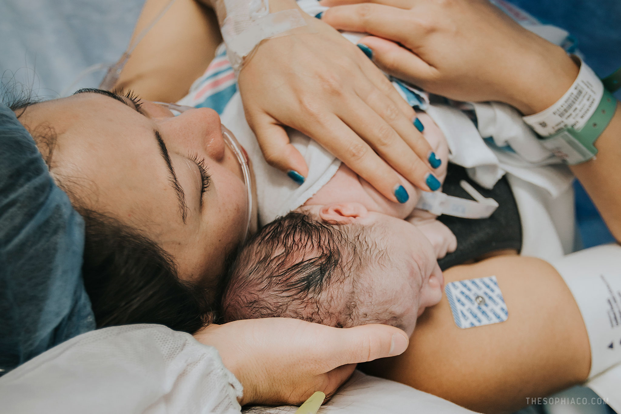 c section birth photography hawaii