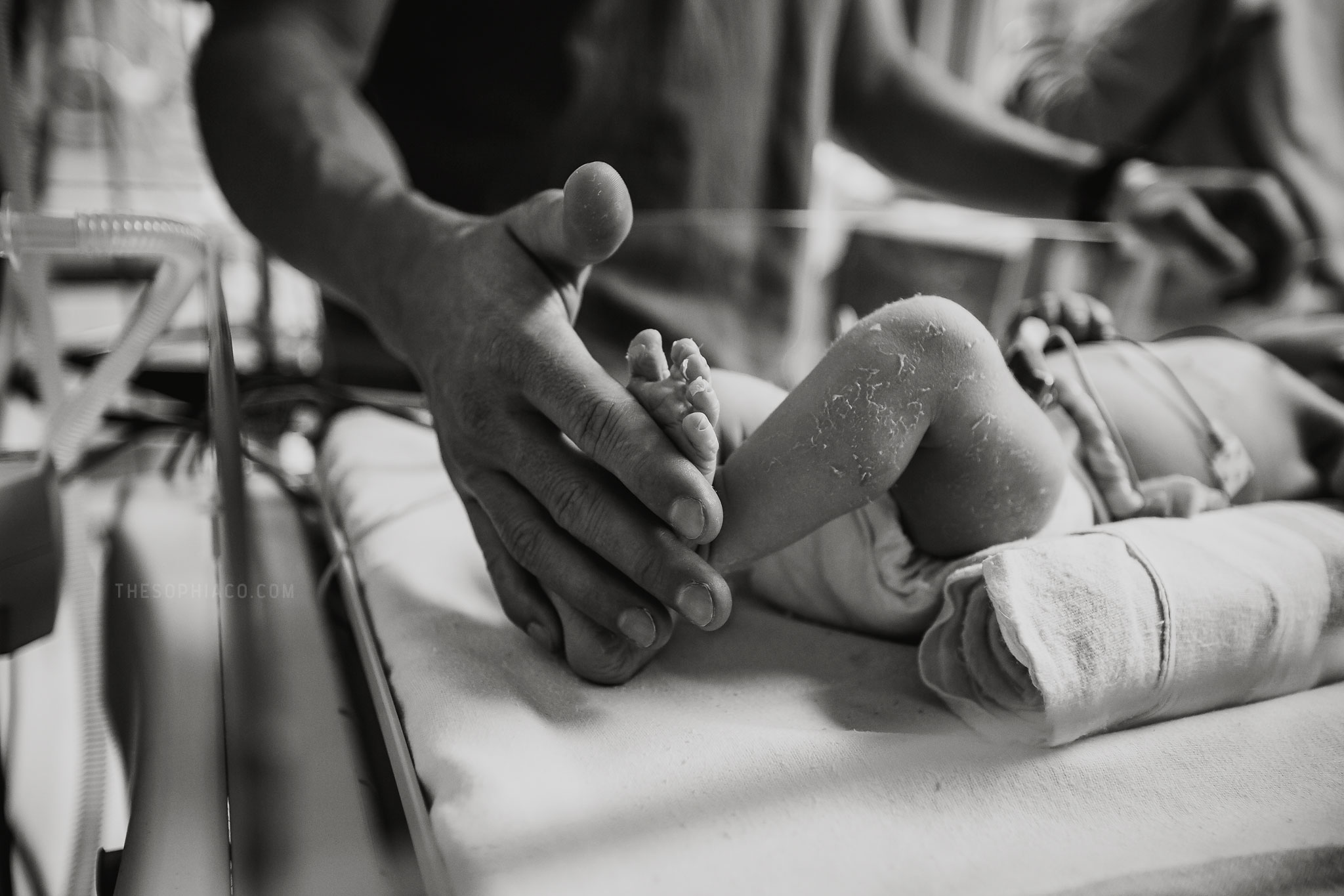 c section birth photography hawaii