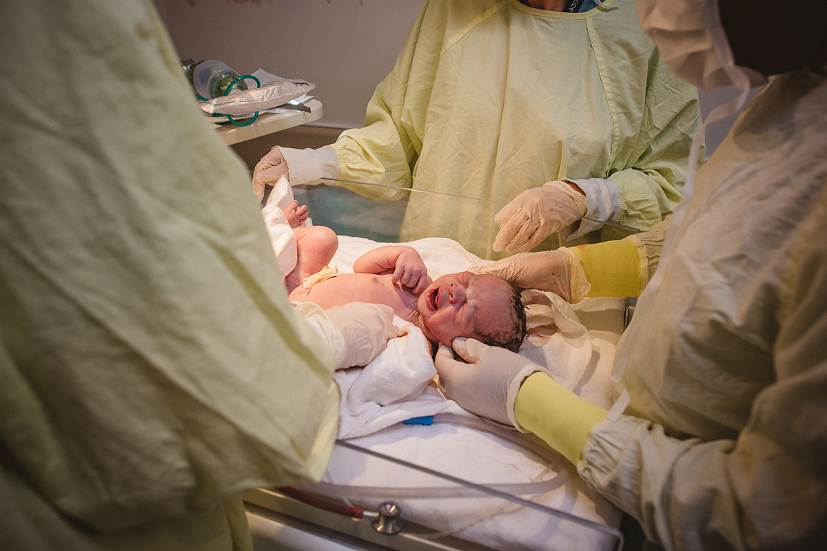 Elliana Gilbert cesarean breech 13.jpg