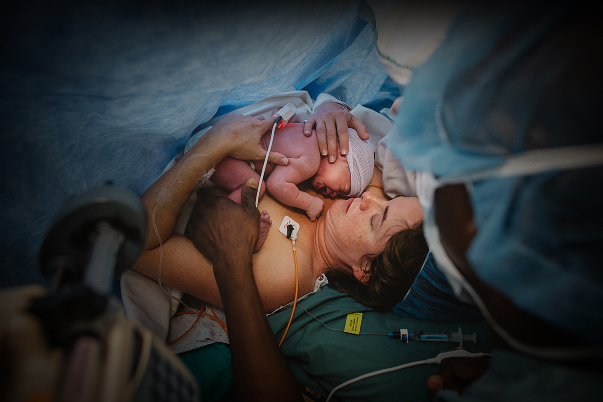 Elliana Gilbert cesarean breech 14.jpg