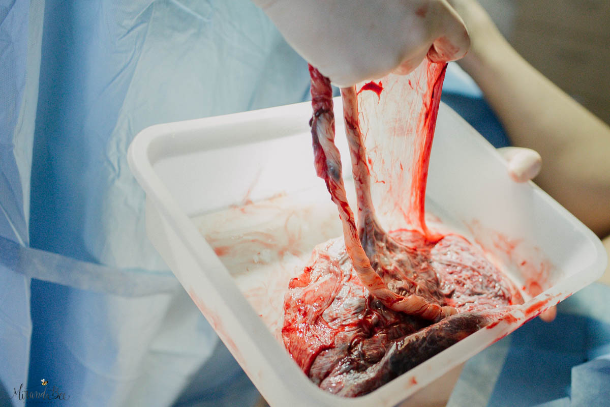 Placenta
