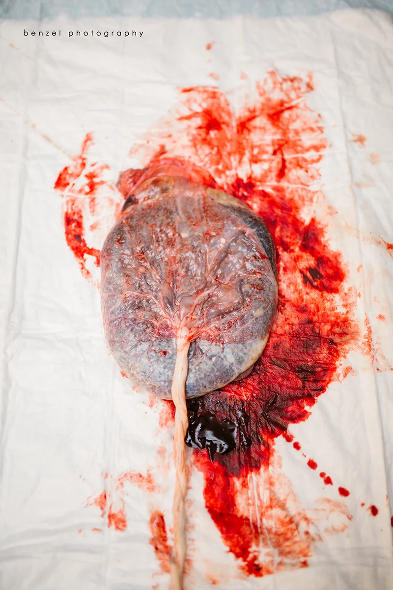 Placenta