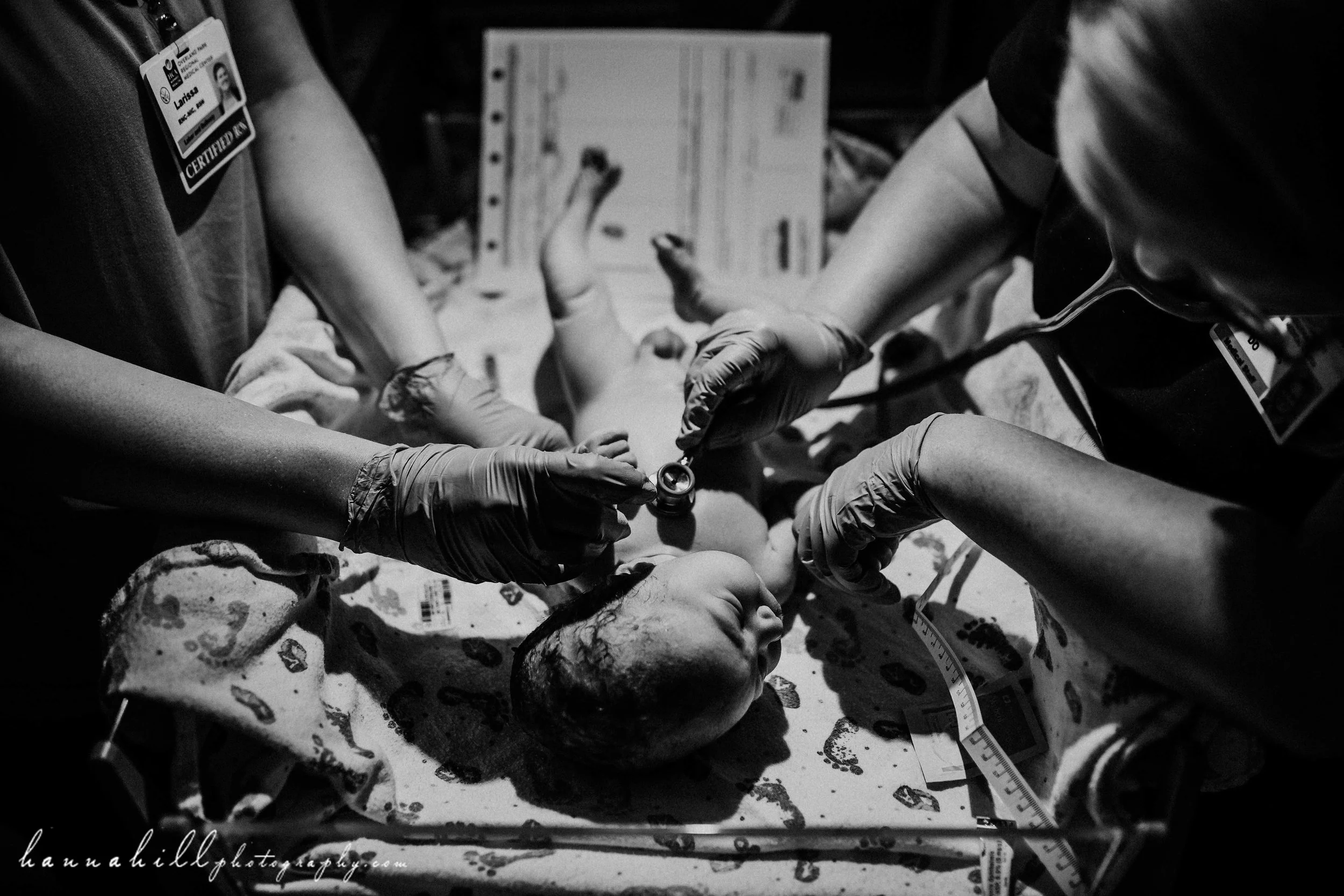 Baby check up