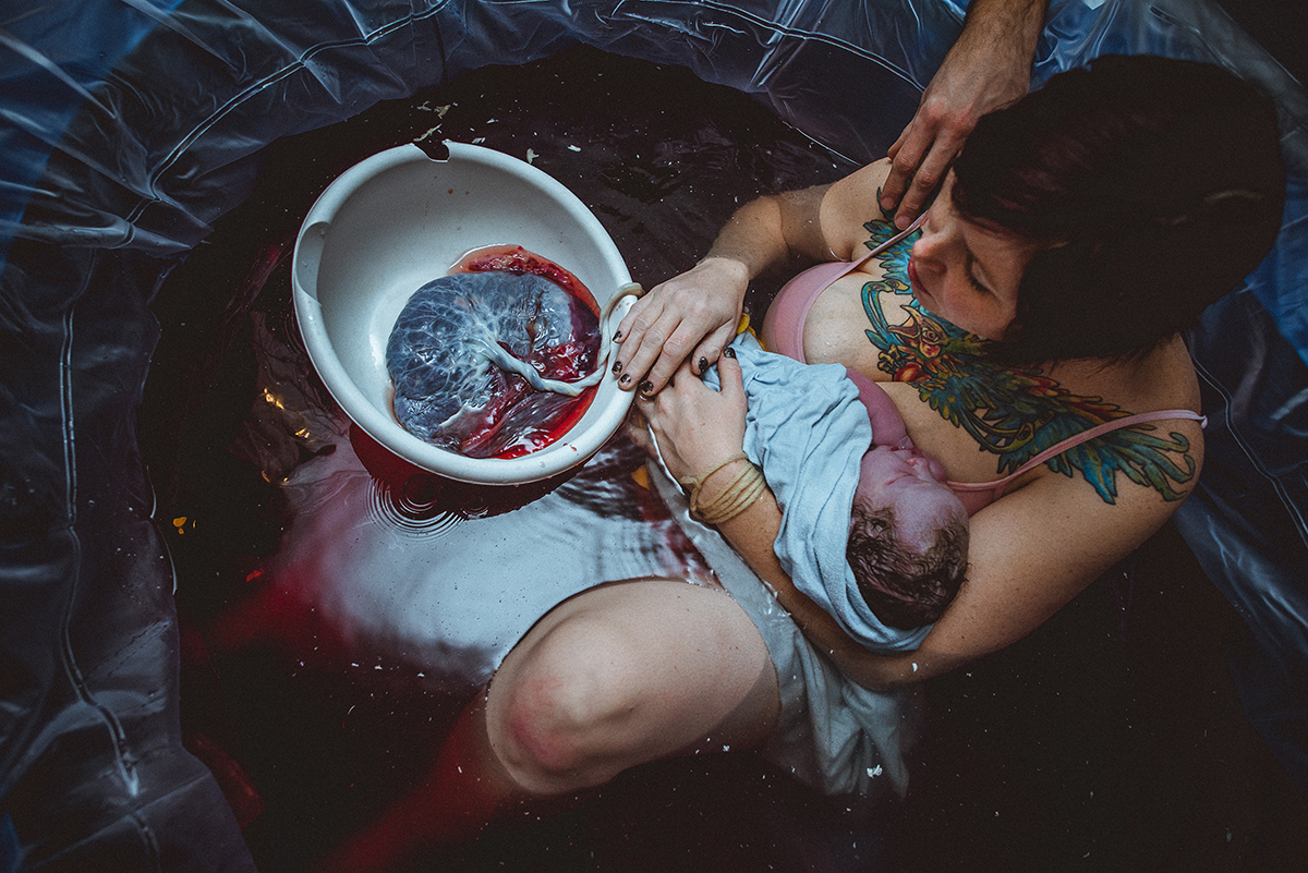 Placenta delivered