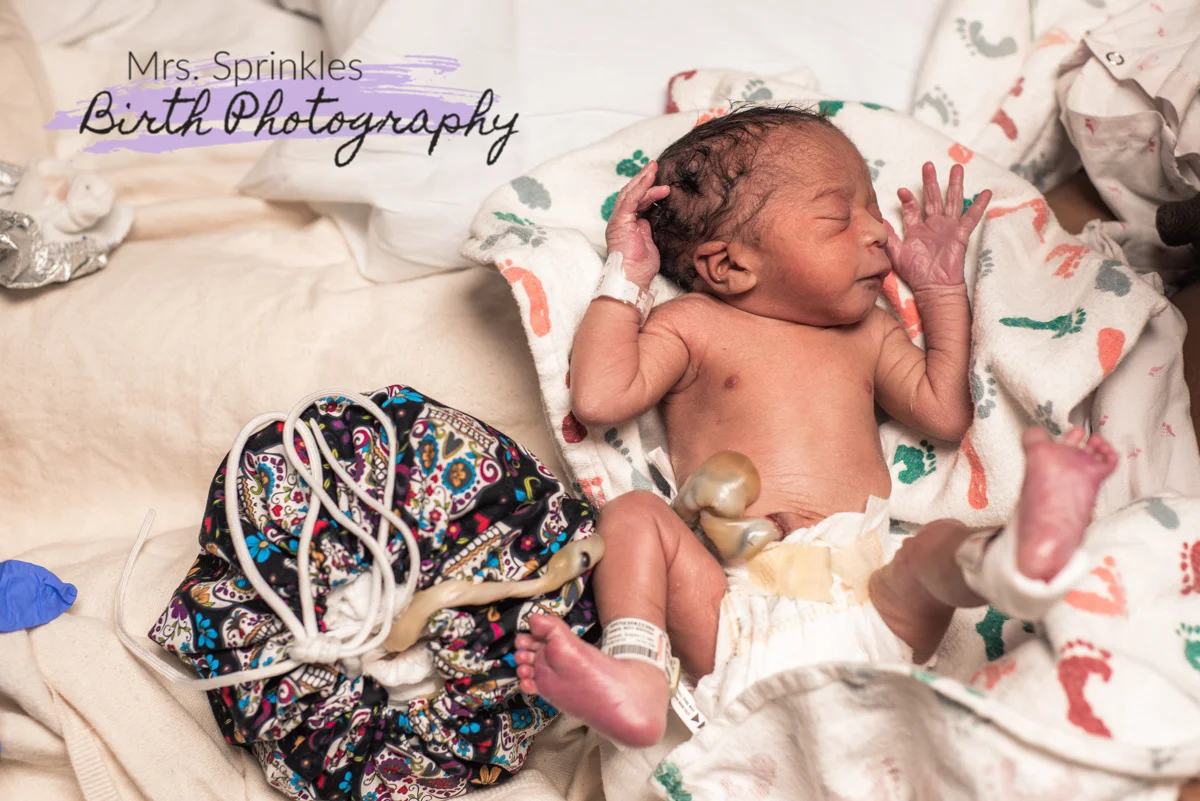 Cesarean Lotus Birth, Greensboro, North Carolina — Birth Her